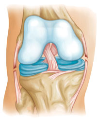 Common Knee Injuries_img6