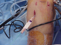 SurgicalProcedure_Img