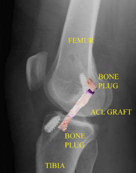 SurgicalProcedure_Img2