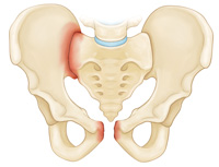 pelvis-img5