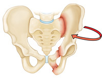 pelvis-img6