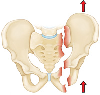 pelvis-img7